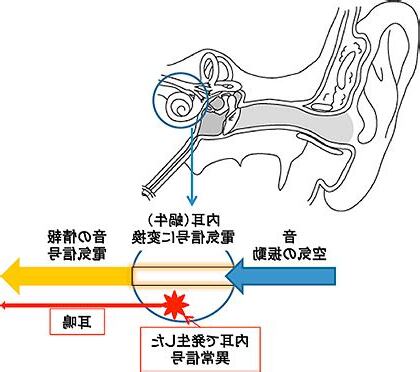 耳鳴 時間